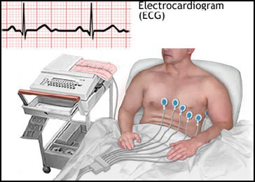 Echocardiography Karachi Home Health care Services (www.UNIQUE-hms.com)