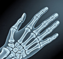 All Body Parts X-Ray Medical Healthcare Services for Karachi Home by UNIQUE-hms.com